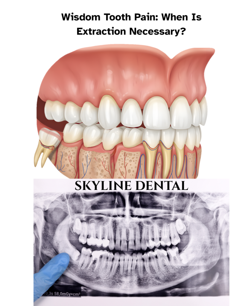 Dentist explaining wisdom tooth pain and extraction in Whitefield