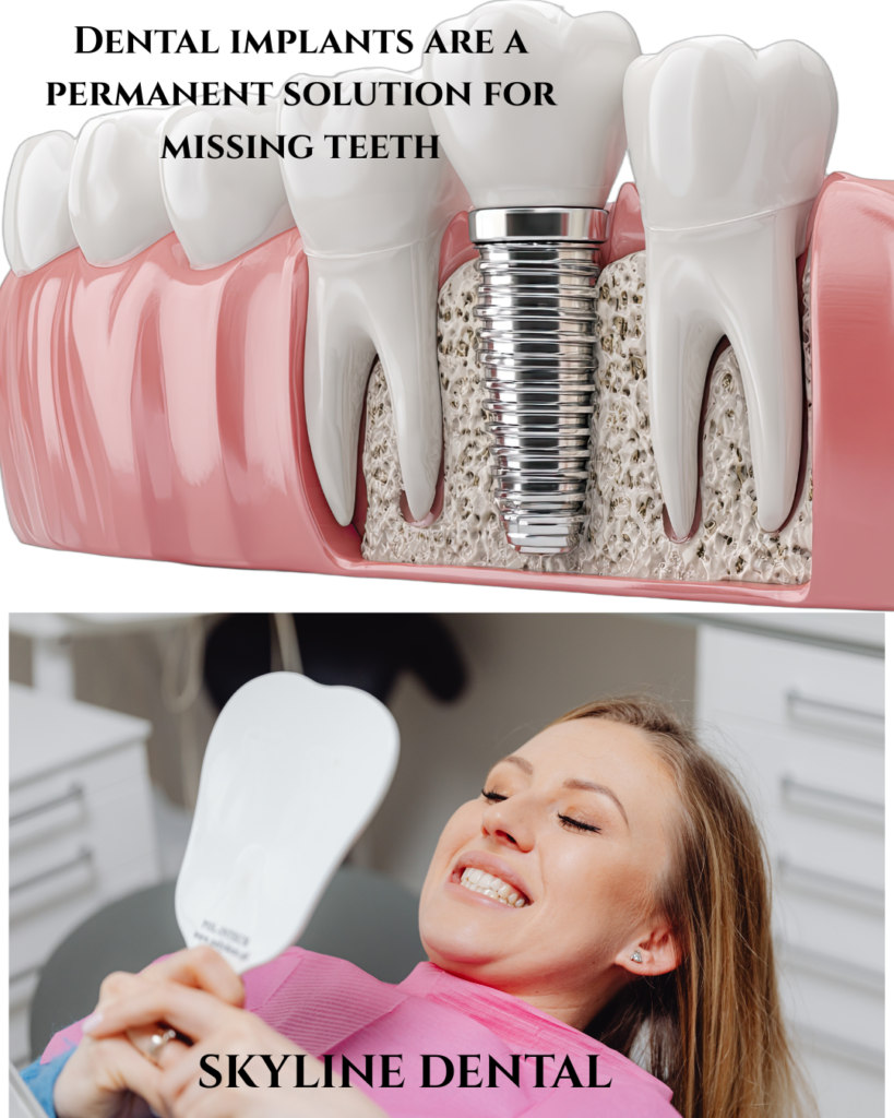 Dental implants in Whitefield for missing teeth replacement