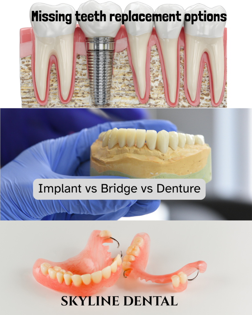 Missing teeth replacement options in Whitefield dental clinic