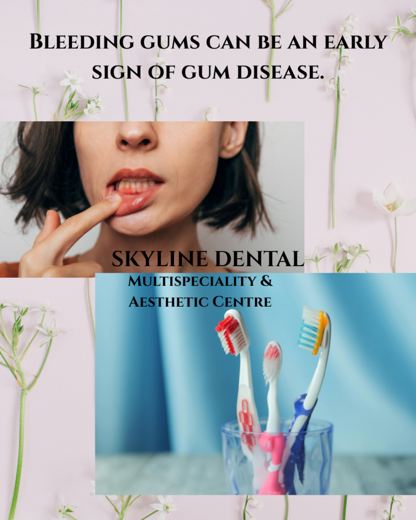 bleeding gums treatment dentist whitefield