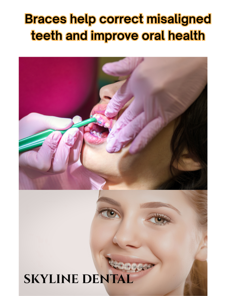 braces treatment by orthodontic dentist in whitefield