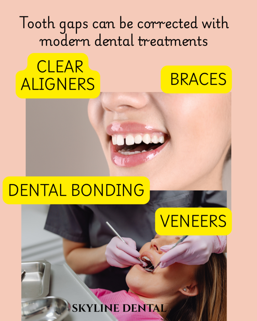 Gap between teeth treatment in Whitefield