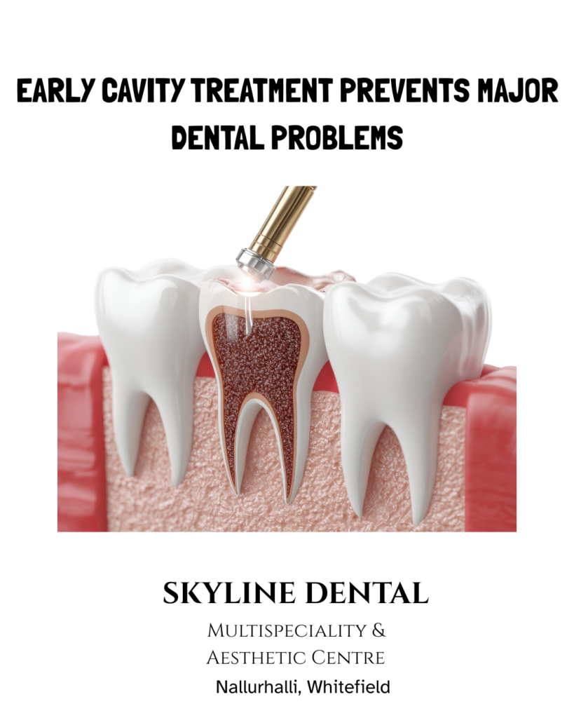 tooth cavity treatment by dentist in whitefield