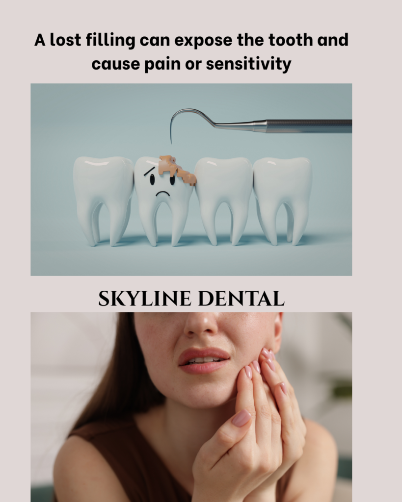 Lost filling treatment by dentist in Whitefield
