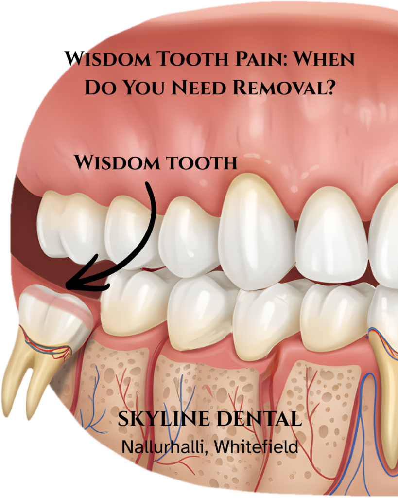 wisdom tooth pain treatment whitefield