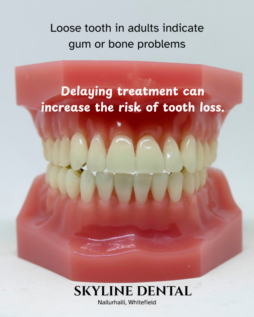 loose tooth treatment whitefield