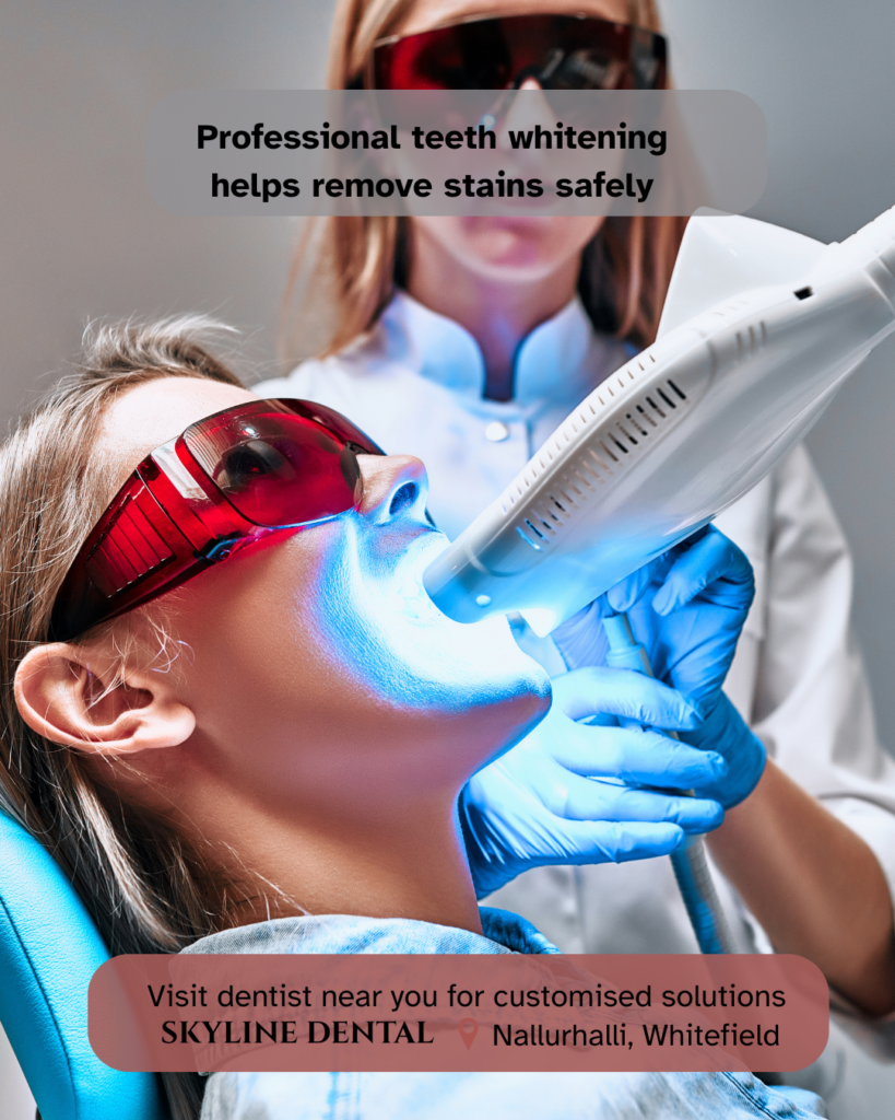 teeth whitening treatment whitefield
