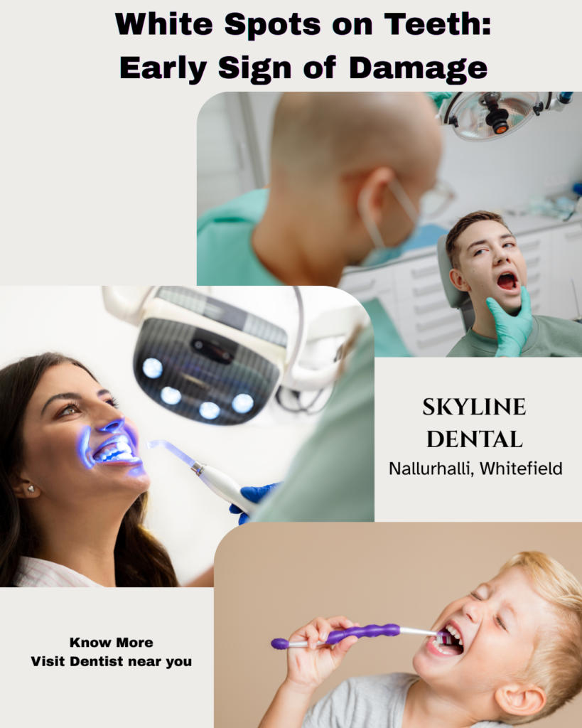 white spots on teeth treatment whitefield