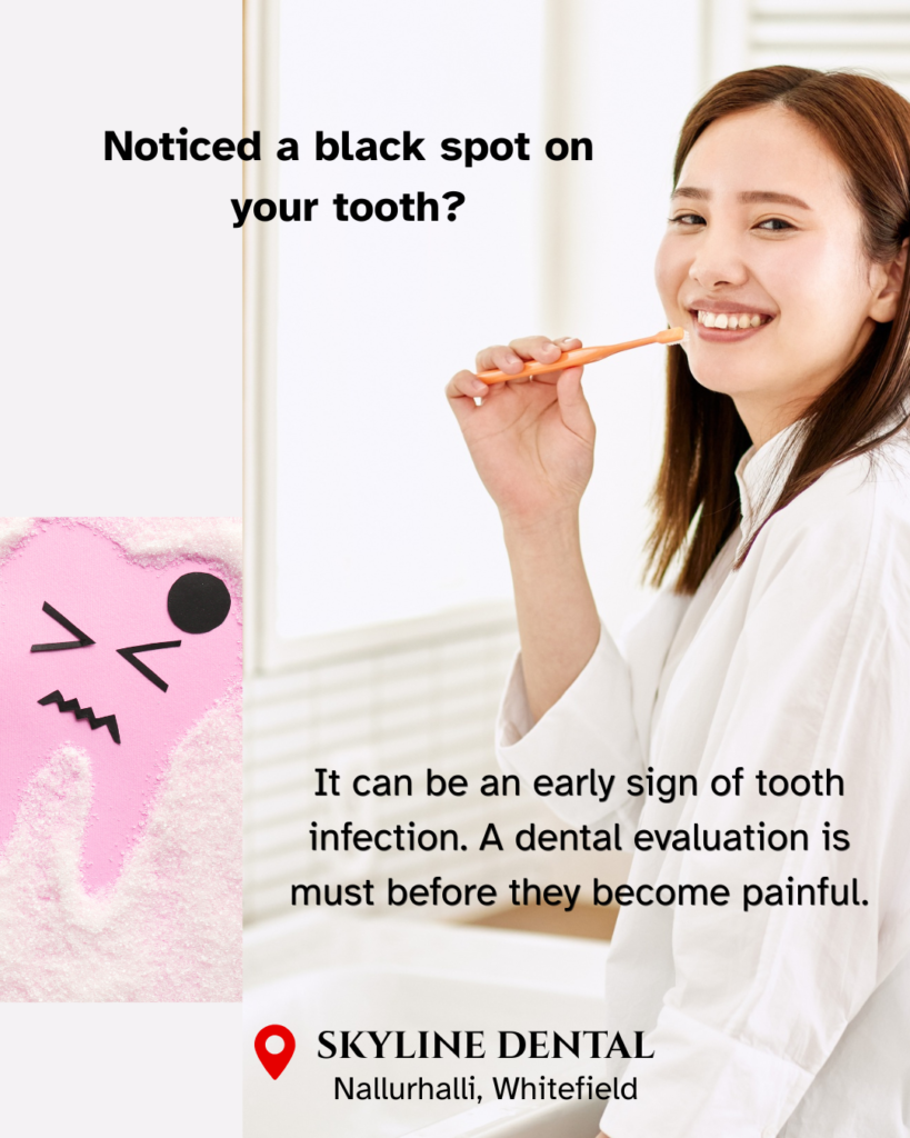 black spot on tooth treatment whitefield bangalore