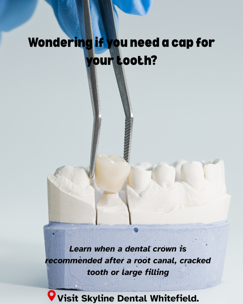 cap for tooth treatment whitefield bangalore