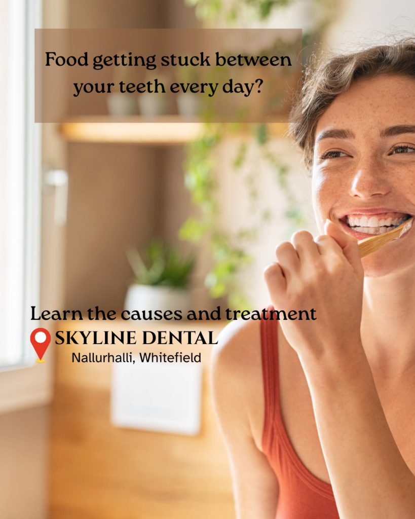 food getting stuck between teeth treatment whitefield bangalore