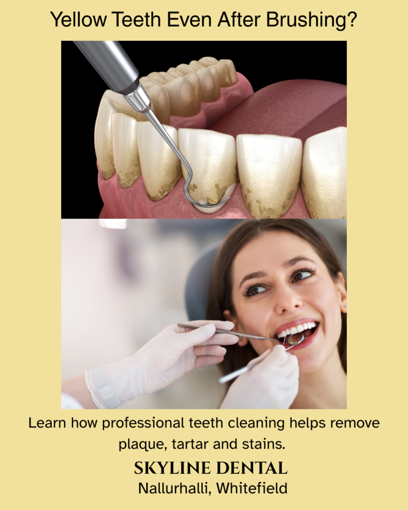 professional teeth cleaning whitefield bangalore