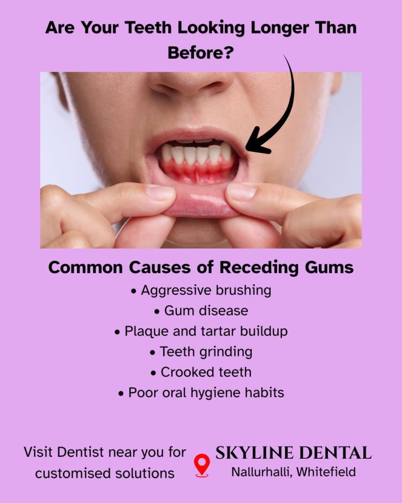 receding gums treatment whitefield bangalore