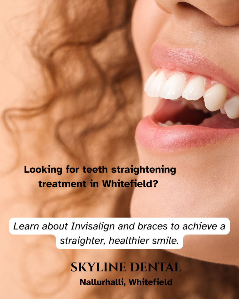 teeth straightening treatment whitefield bangalore