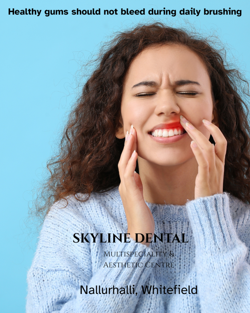 Dentist explaining bleeding gums causes and gum care treatment to a patient at Skyline Dental Whitefield Bengaluru