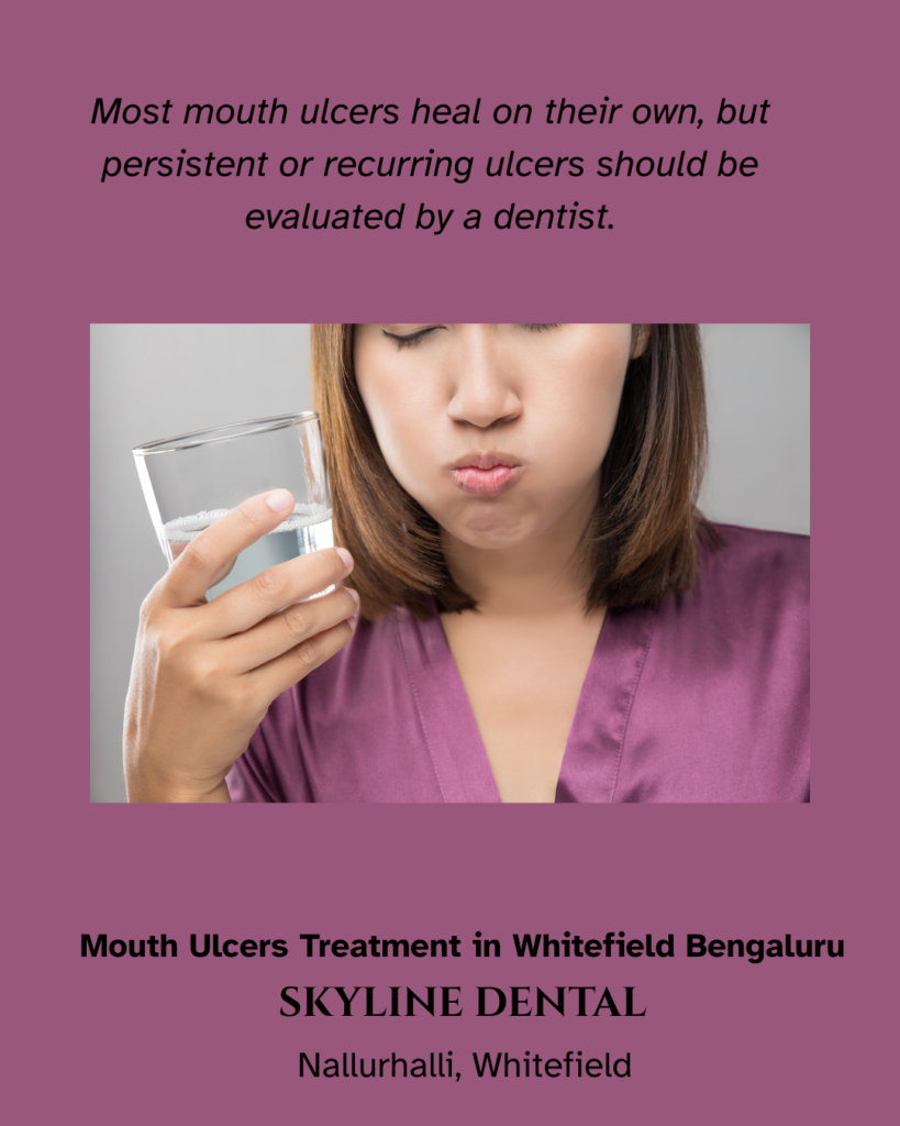 Mouth ulcers treatment and causes explained by a dentist in Whitefield Bengaluru