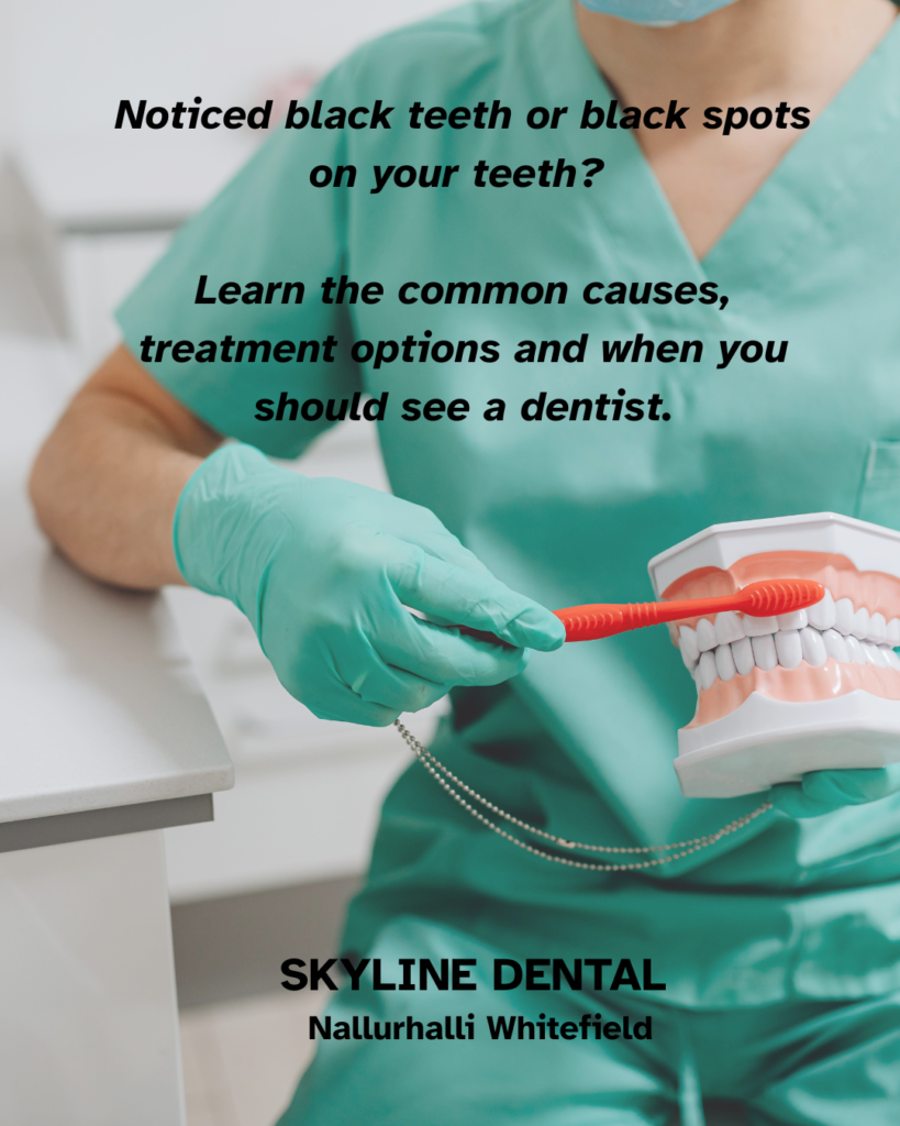 Black spots and dark discoloration on teeth requiring dental examination
