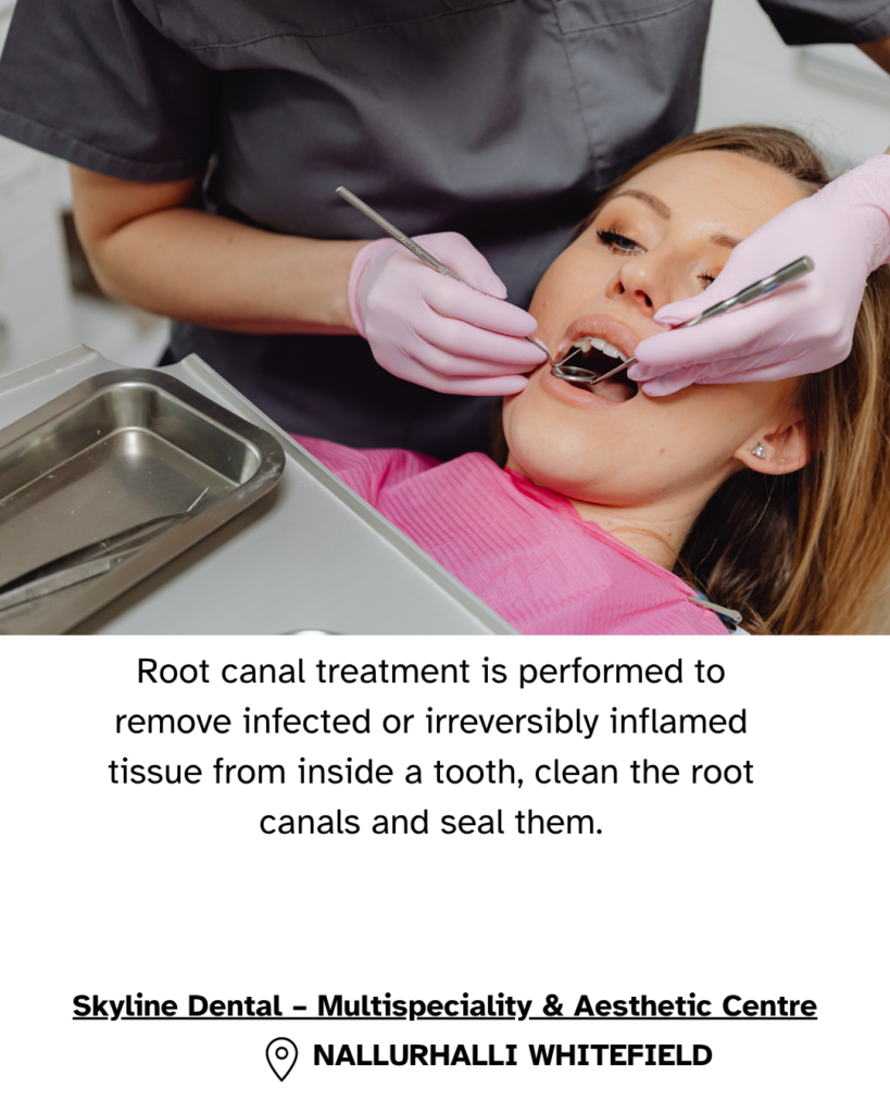 Pain after root canal treatment and dental evaluation in Whitefield Bengaluru